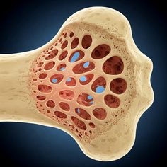 Spinal inflammation in Ankylosing Spondylitis