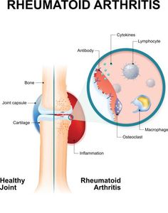 Diet and Inflammation: What the Science Says